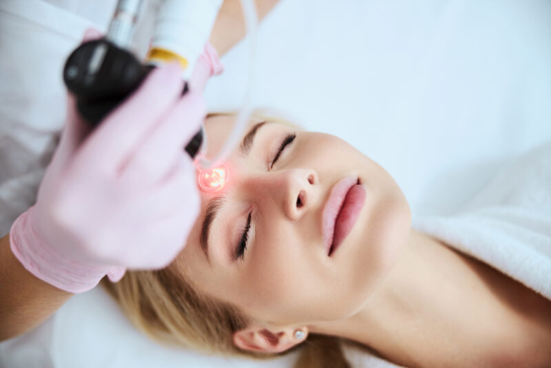 Tranquil,Female,Patient,Lying,With,Closed,Eyes,During,The,Laser